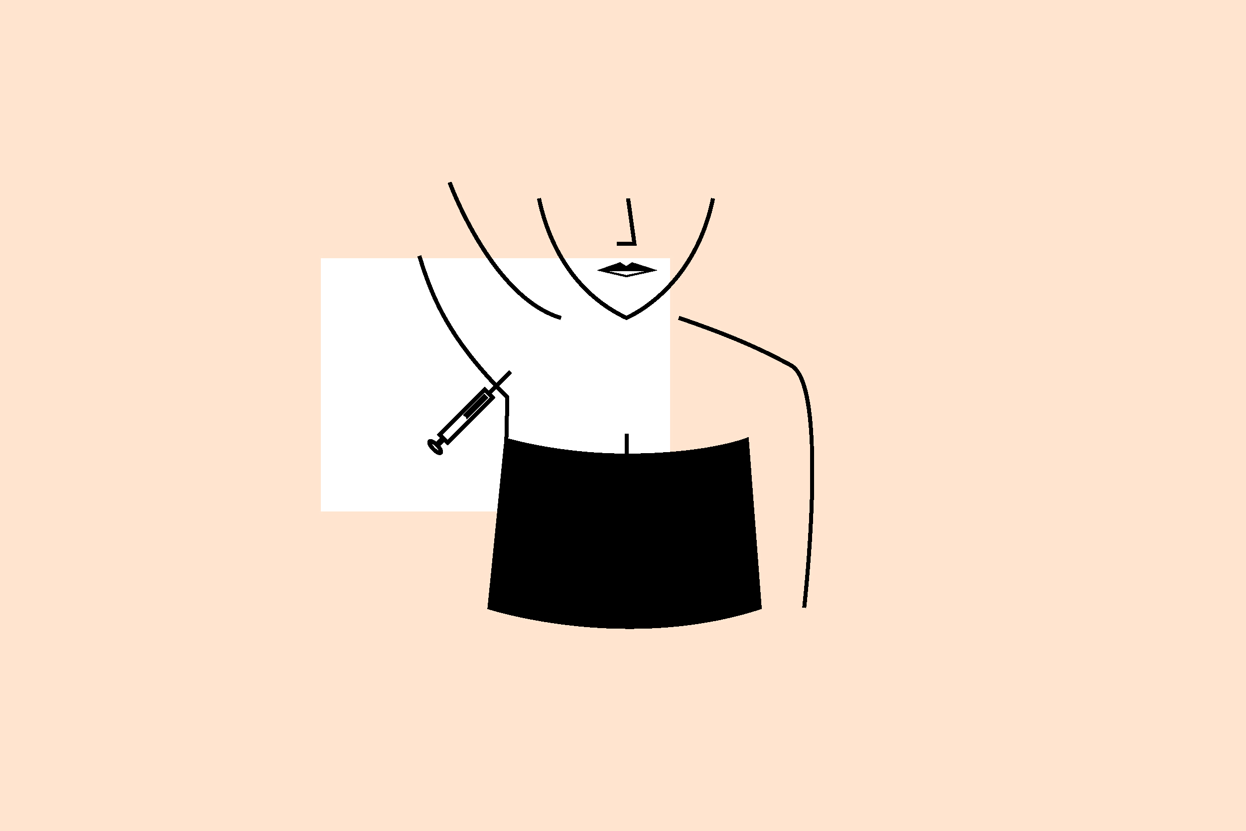Hyperhidrosis